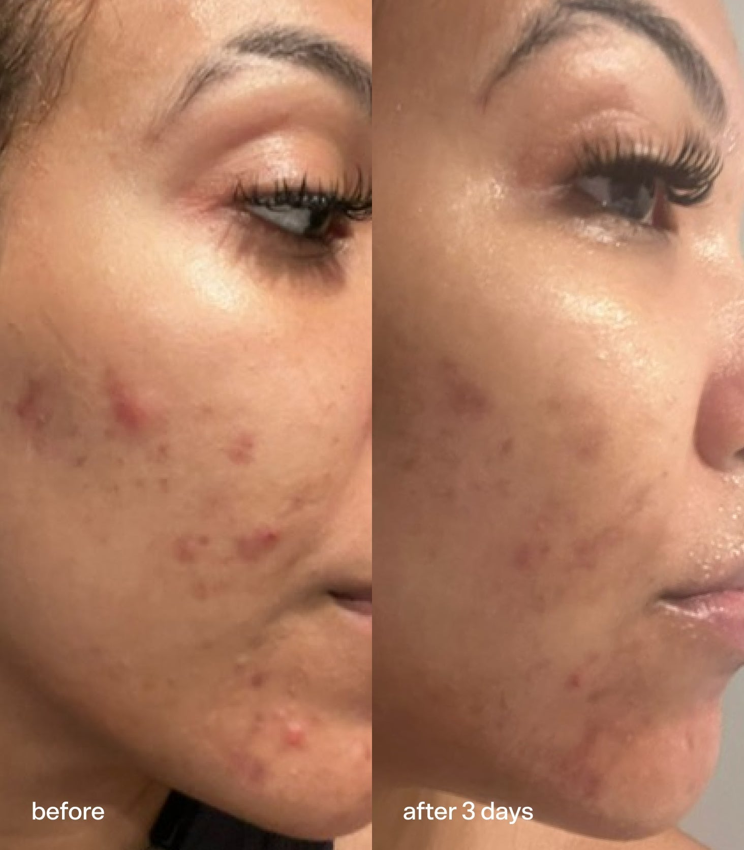 Bubble Skincare Knock Out