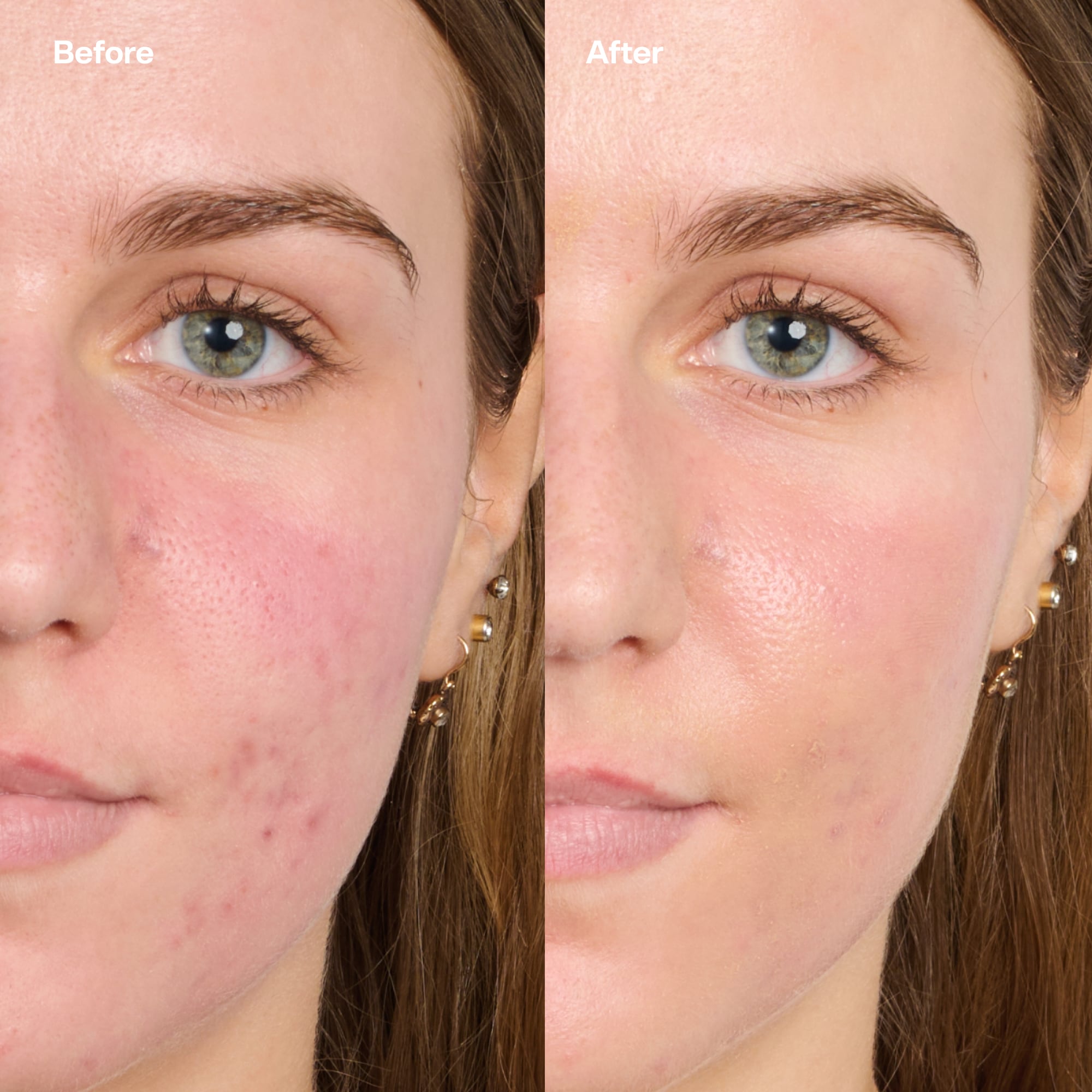Bubble Skincare Secret Agent
