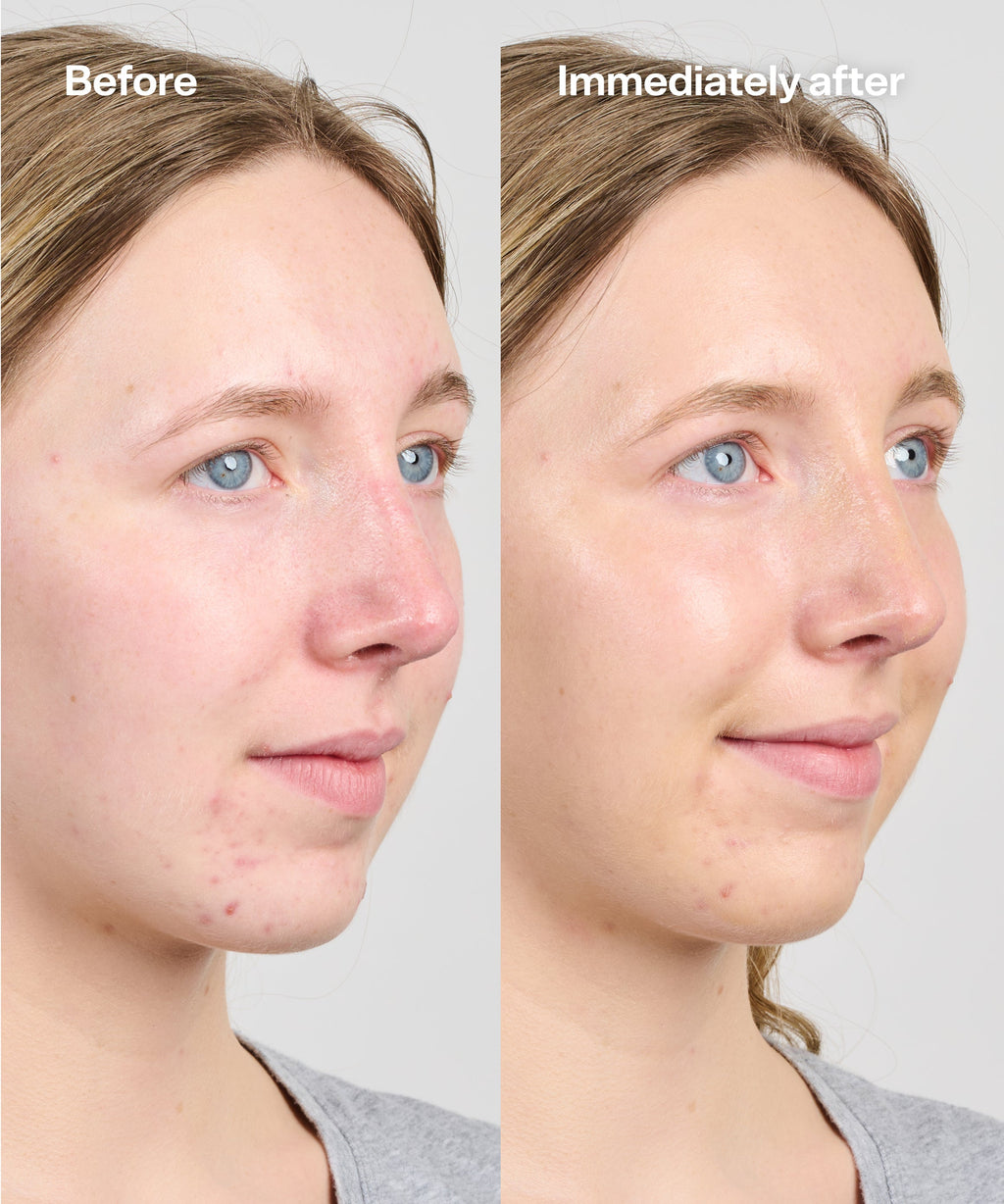 Bubble Skincare Secret Agent