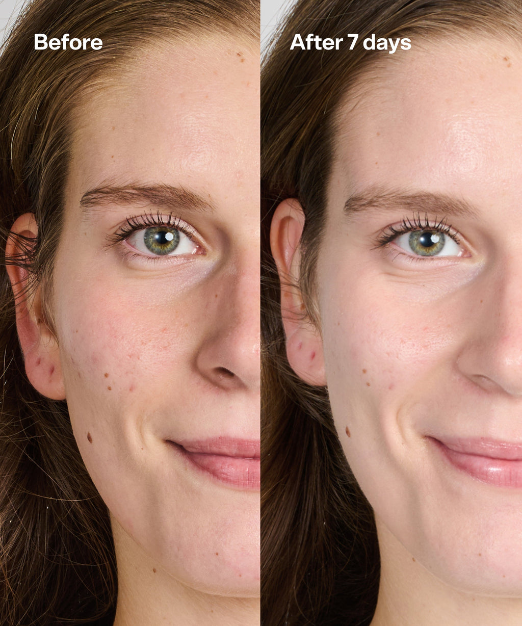 Bubble Skincare Secret Agent