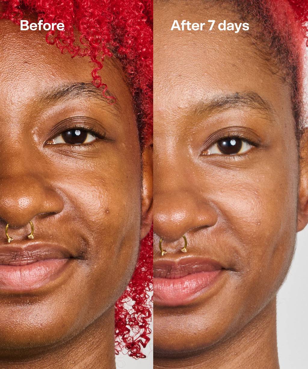 Bubble Skincare Under Cover
